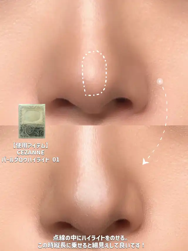 【小鼻整形級!!】嫌な団子鼻とはサヨナラ今日から簡単！小鼻縮小術！！